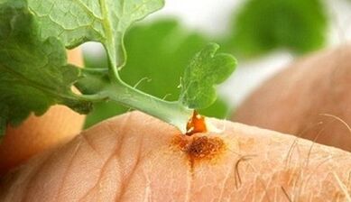 Bir Selandin ile Bir Siğil Nasıl Alınır